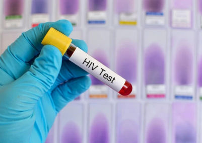 UNAIDS raises alarm over deaths of 45,000 persons living with HIV in Nigeria