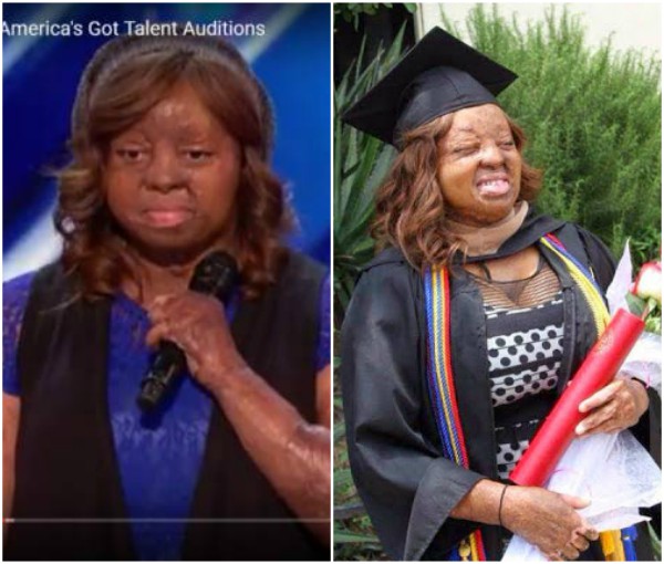 How Sosoliso plane crash survivor graduated with First Class degree