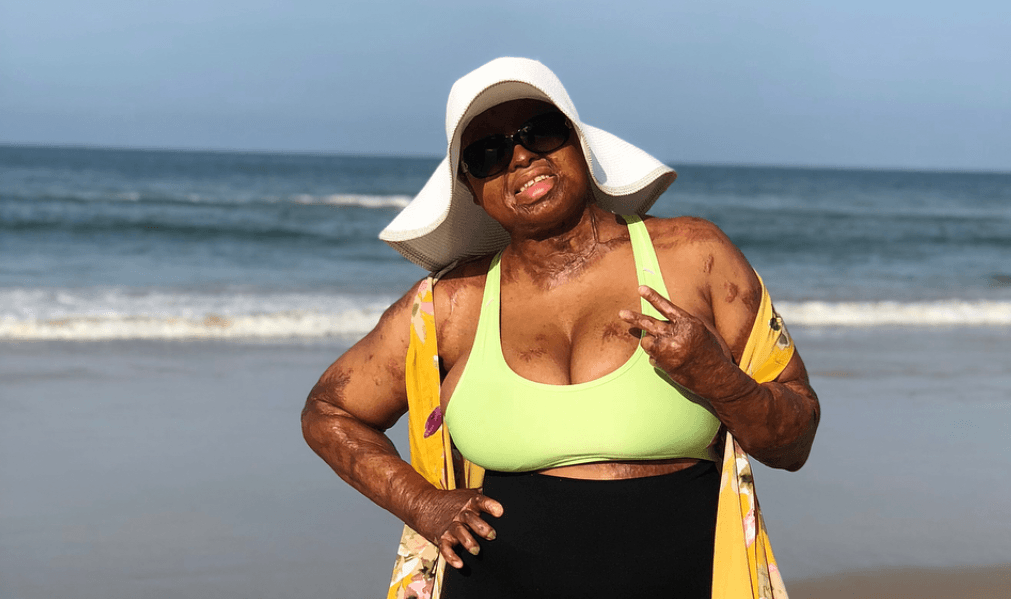 Sosoliso plane crash survivor, Kechi Okwuchi flaunts body in beach photos