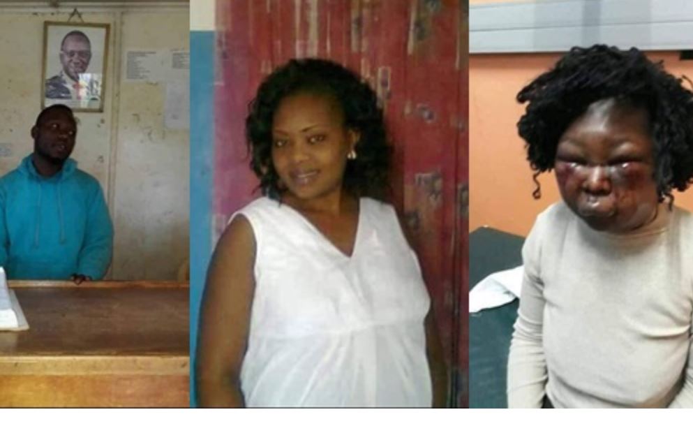 Police arrest man for beating his pregnant wife mercilessly over food [Photos]