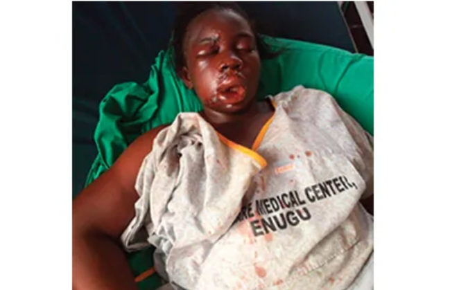 Three IMT students in critical condition as hostel collapses