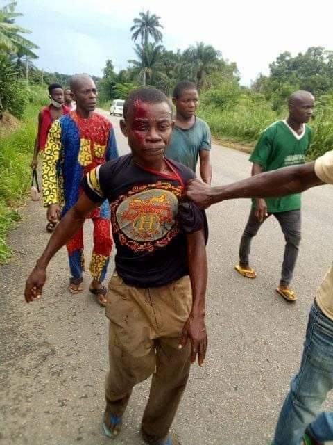 Tragedy! Man stabs cousin to death over Mango [WARNING: GRAPHIC CONTENT]