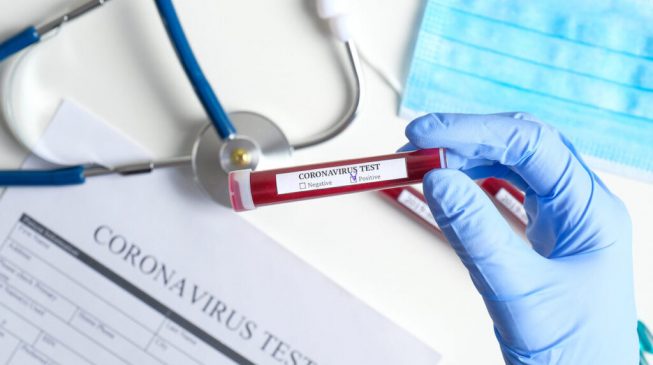 COVID-19: Nigeria records three new deaths, 477 cases in 24 hours