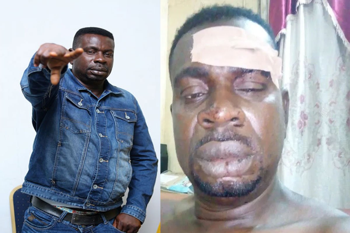 Save me from depression – Baba Fryo laments