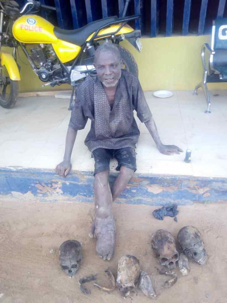 Man arrested with four human skulls, hands, other body parts – Official