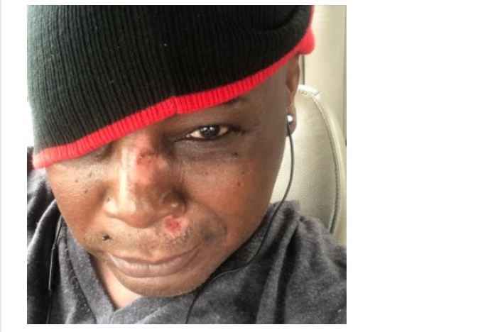 Charly Boy speaks after surviving scooter accident