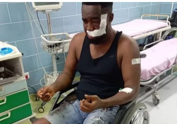 Mr Raw survives ghastly auto crash