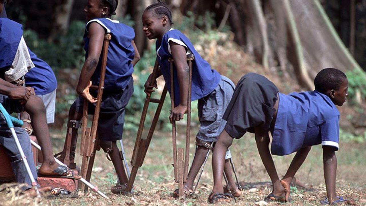 Polio resurfaces in Adamawa, 1 case detected – Official