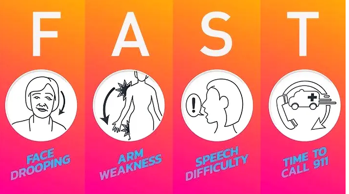 World Stroke Day: Minutes can save precious time