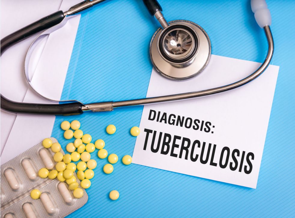 Most Nigerians have little knowledge of TB – Experts
