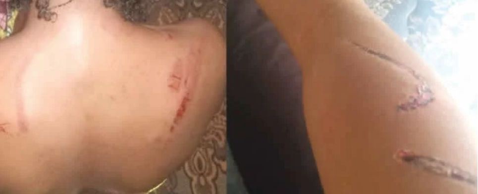 How NSCDC official allegedly brutalizes teenager for having boyfriend