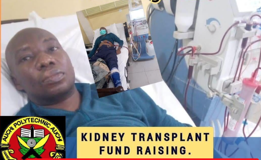 Kidney transplant: Ogbeide desperately needs N9.09m to stay alive