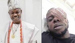 Ogun monarch allegedly blinds trader’s eye for dancing with his queen