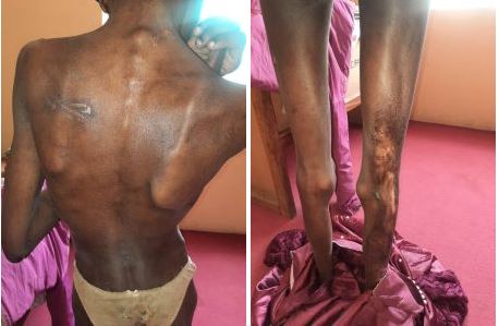 Police rescue caged, malnourished 17-year-old girl in Jos