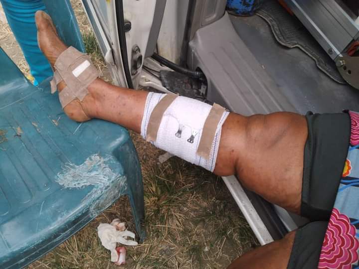 Three injured as explosion rocks Port Harcourt APC rally