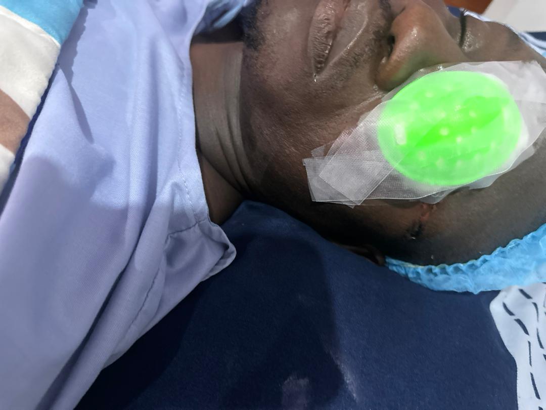 Man laments how an attack by a power drunk Airforce officer on his left eye made him blind+Photos