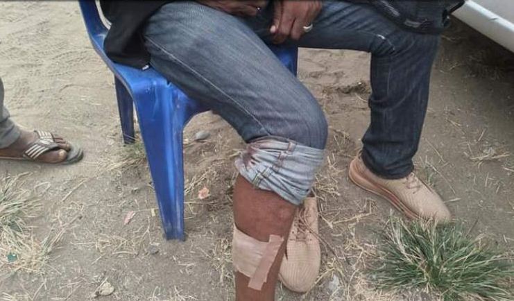 Three injured as explosion rocks Port Harcourt APC rally (PHOTO)