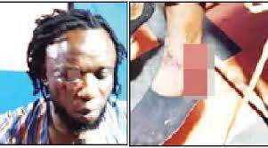 David Umahi’s aide, Uzo accused of beating Ebonyi musician to pulp over campaign song