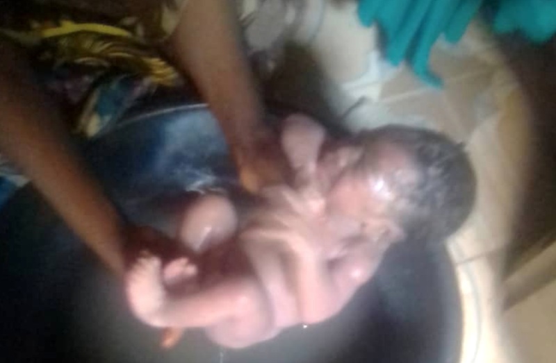 Newborn dumped in pit toilet rescued