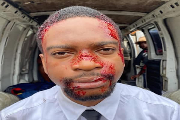 FACTCHECK: Did thugs attack and inflict injuries on Olumide Oworu?