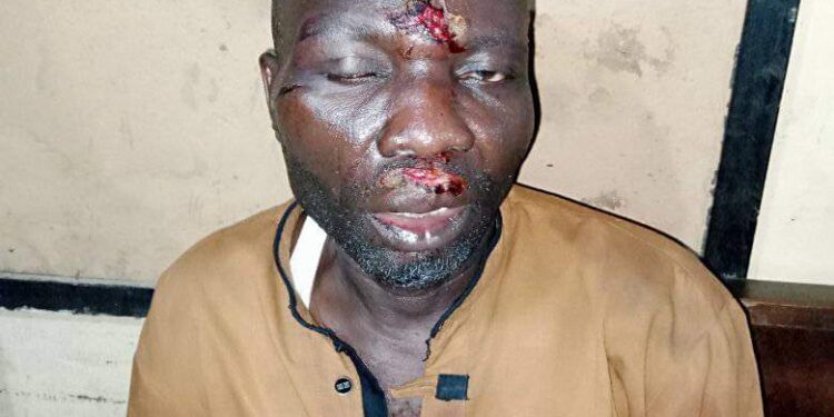 Police probe attack on Ife residents by Oro worshippers, Imam and others injured