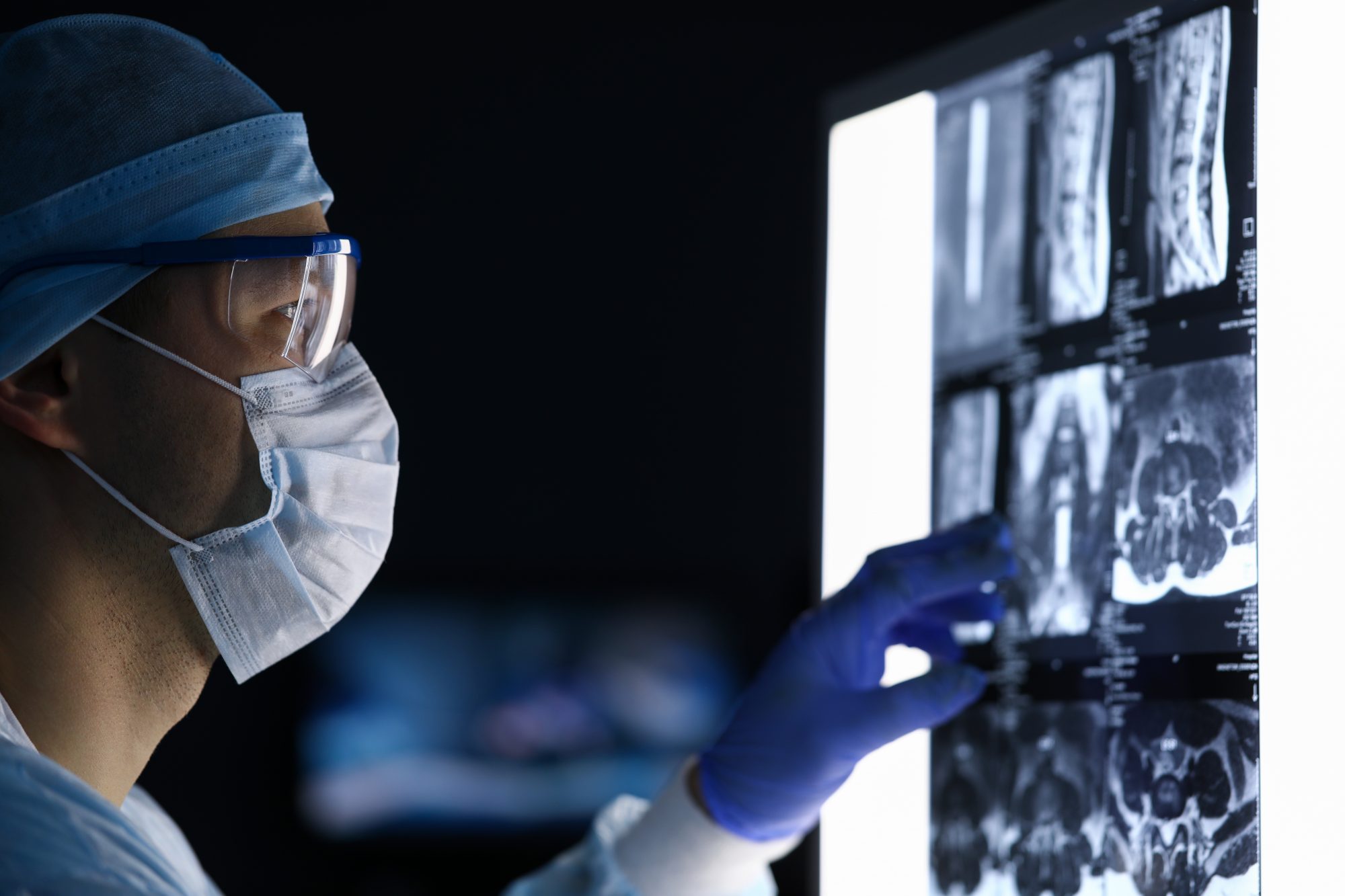 Revolutionary Revolutionary AI technology offers faster cancer treatment for NHS patients