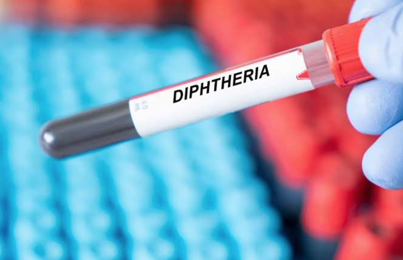 Diphtheria outbreak in Edo claims 2 lives