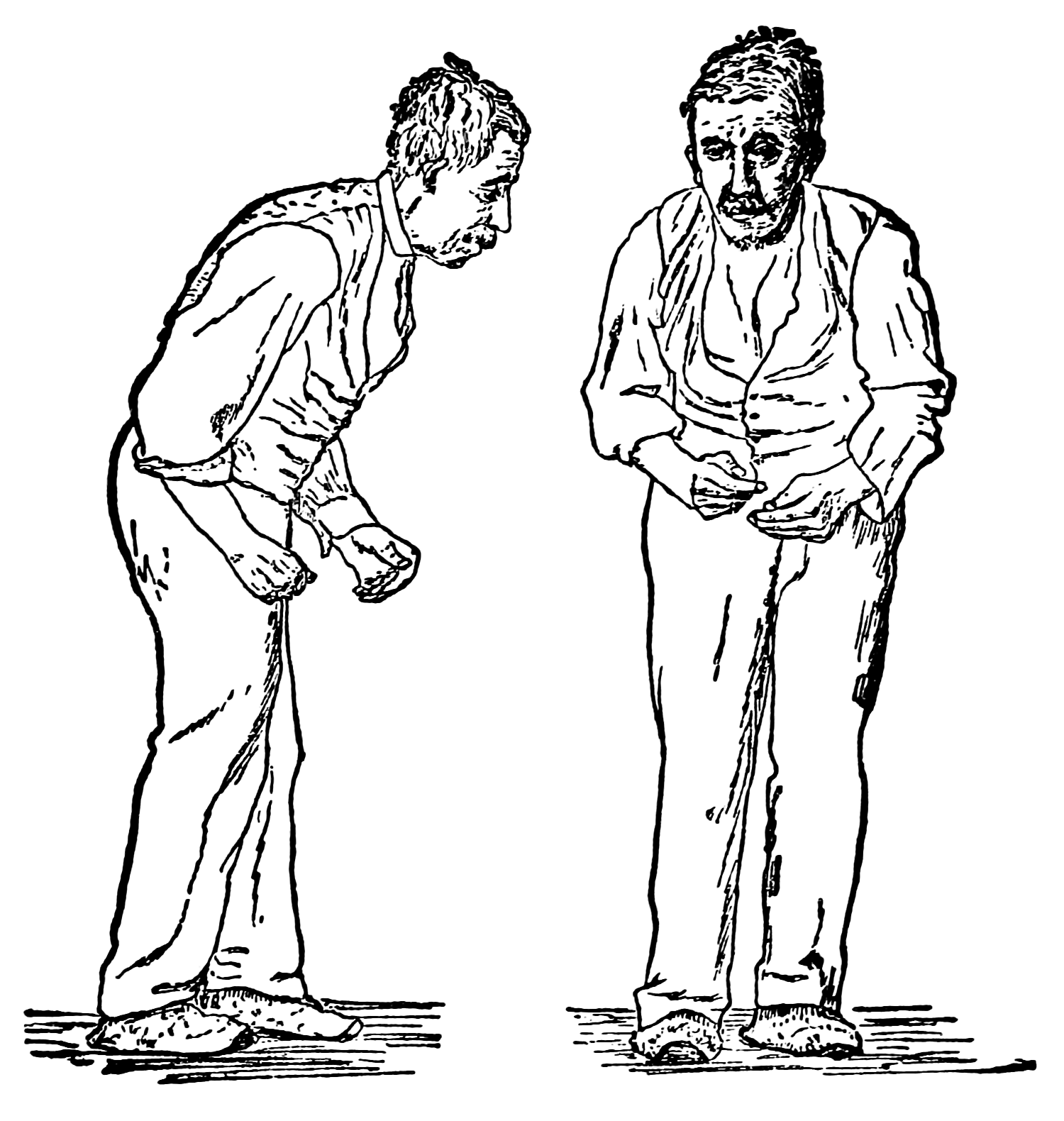 About 78 per cent of elderly Nigerians at risk of Parkinson disease, says Expert