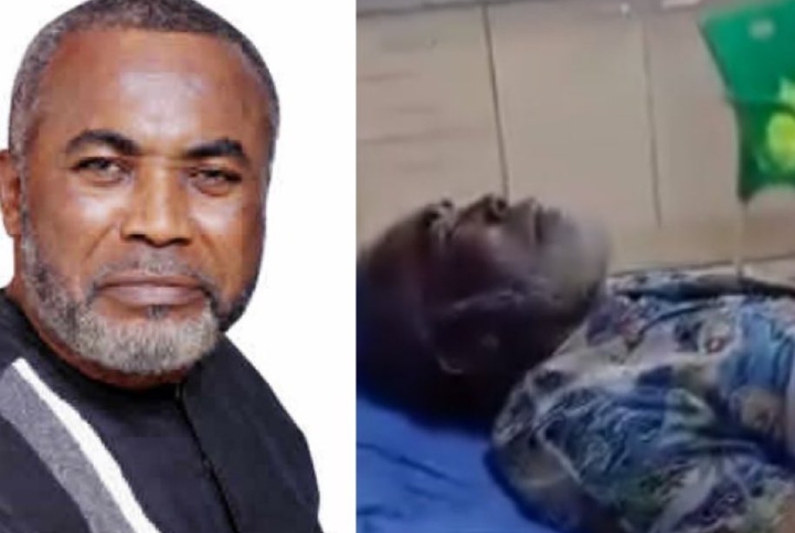 He’s alive, he had neuro surgery – Minister reveals outcome of visit to Zack Orji in hospital