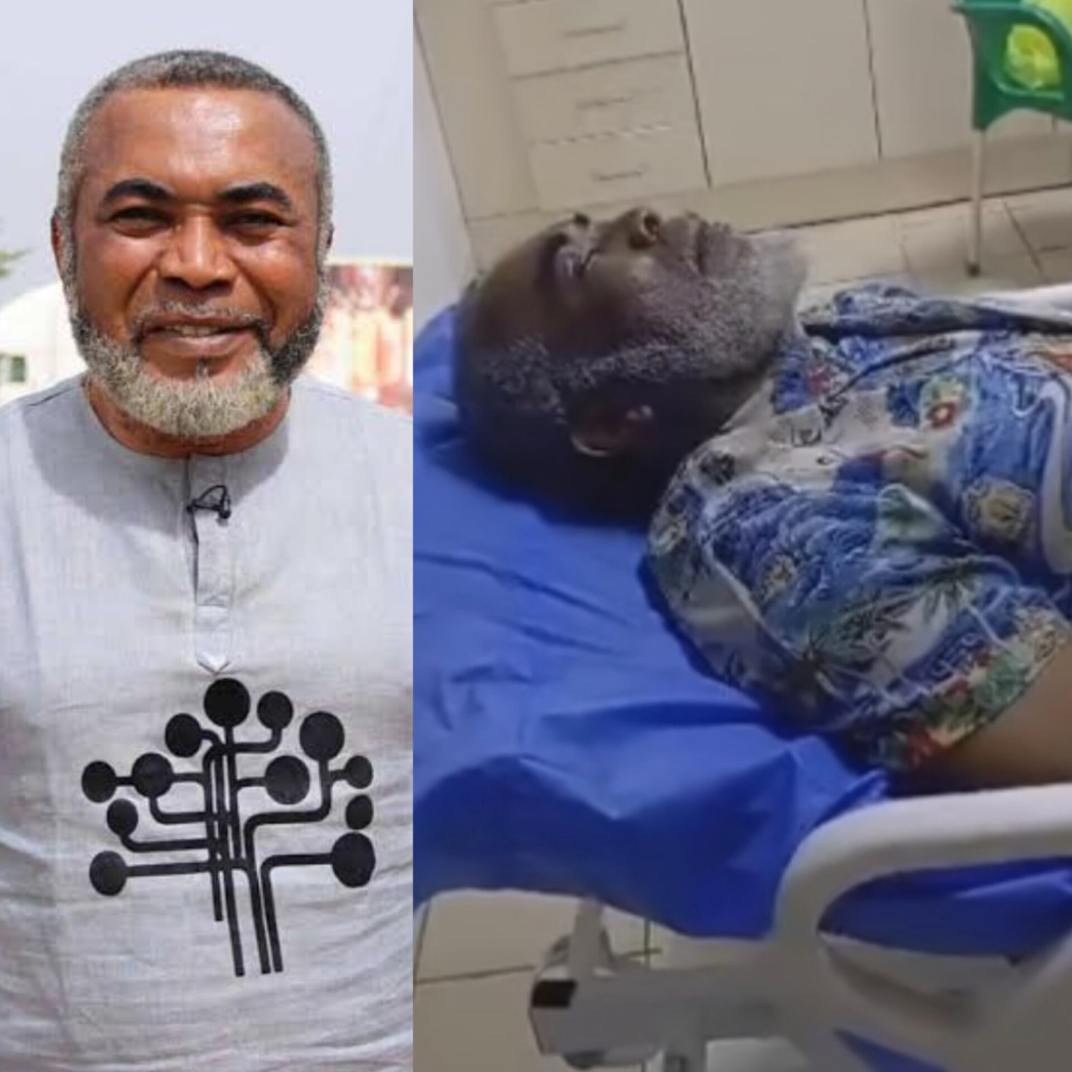 How Zack Orji survived two brain surgeries – Actors Guild