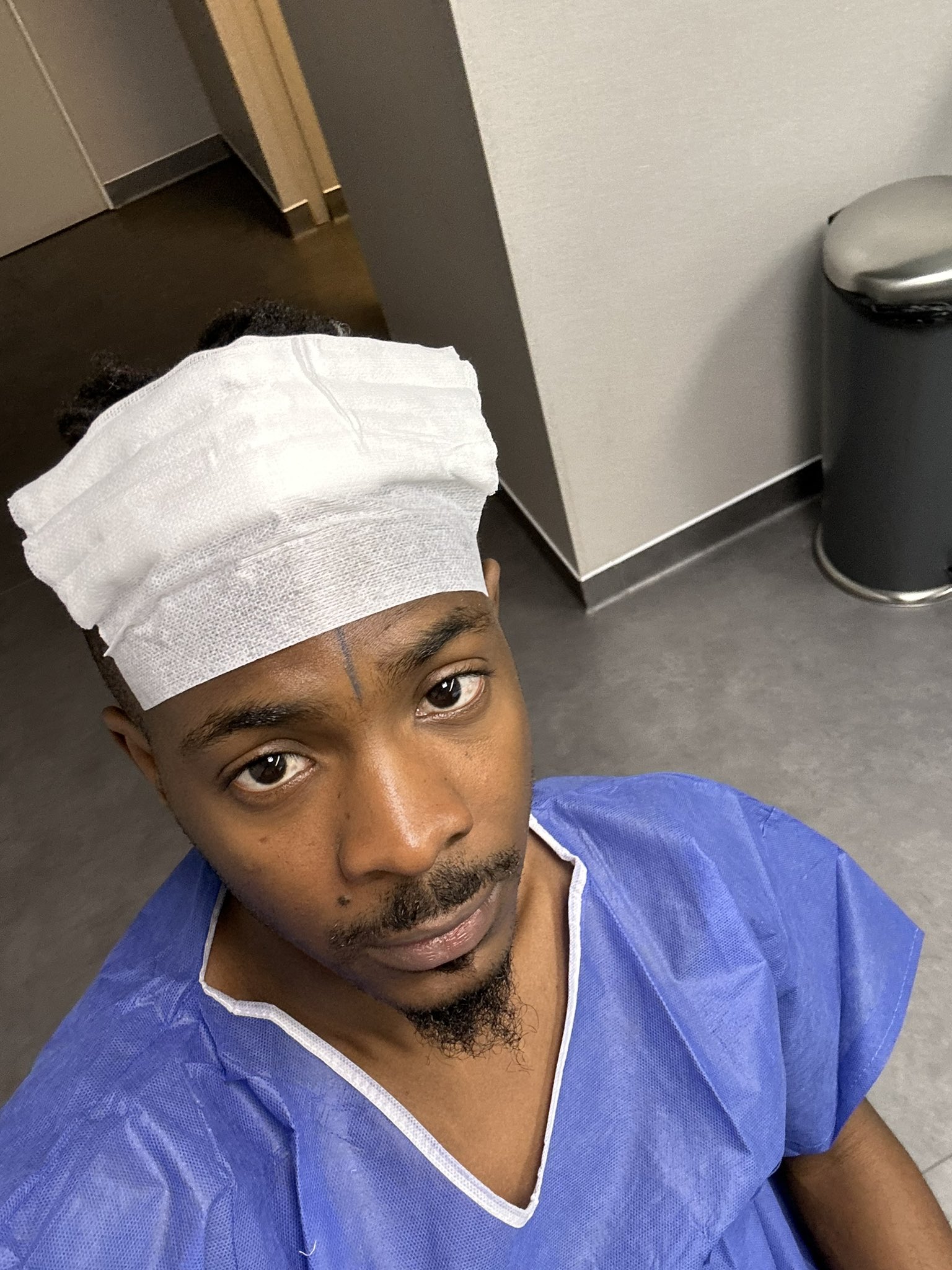 Receding Hair: Music producer, Young Jonn undergoes surgery