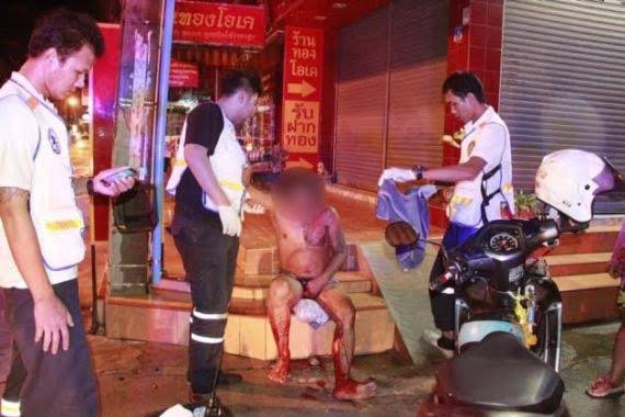 Angry wife, 55, slices husband’s manhood for mentioning another lady’s name while making love