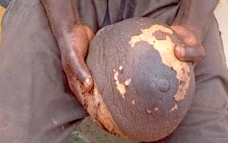 PHOTO: Man arrested with fresh human breast